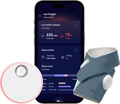 Amazon.com: Owlet Dream Sock Smart Wearable Baby Monitor Tracks Heart Rate & Oxygen in Real Time Parents Receive Alerts, Sleep Insights & More via App